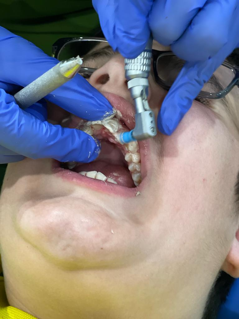 mobile dentist sydney